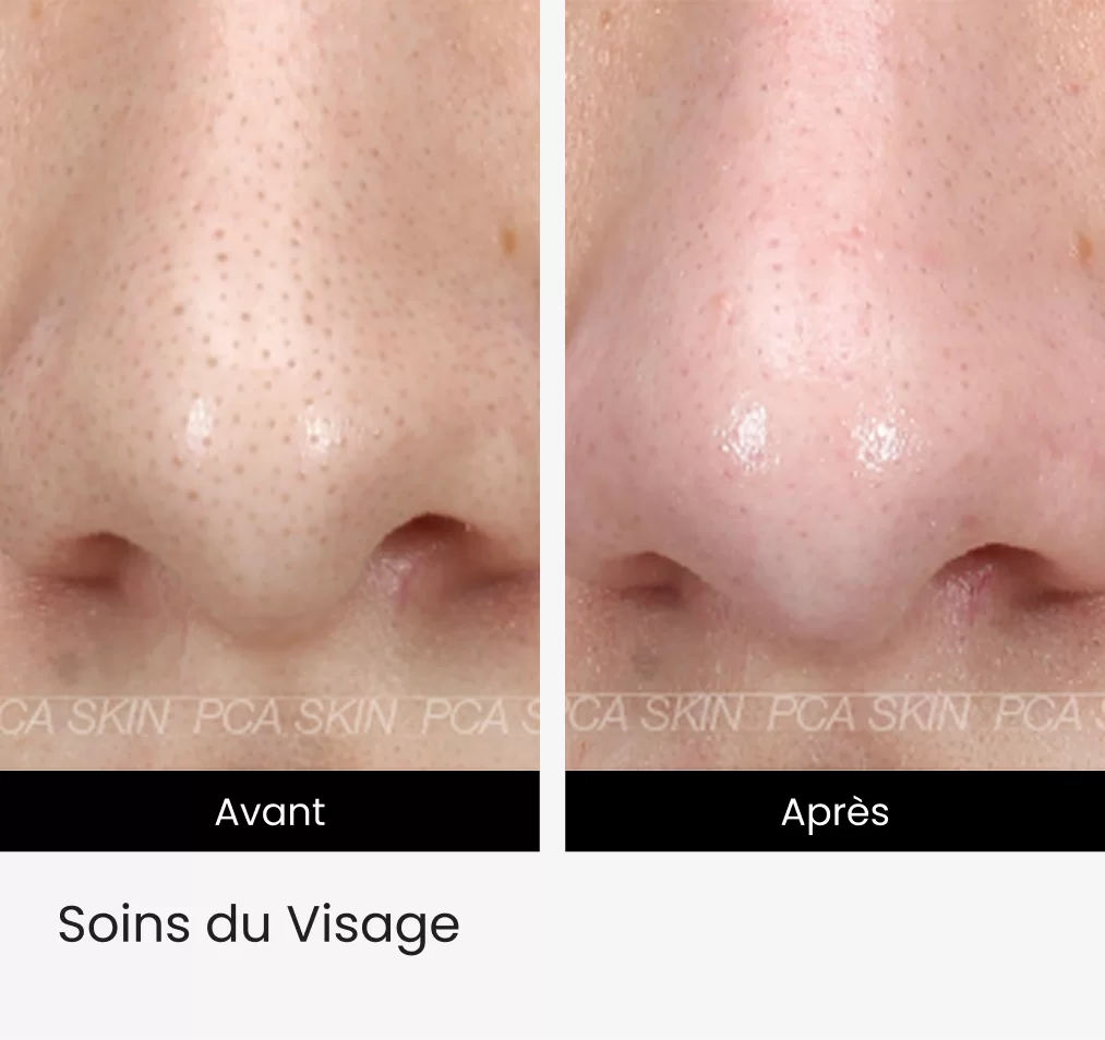 Soins du Visage img